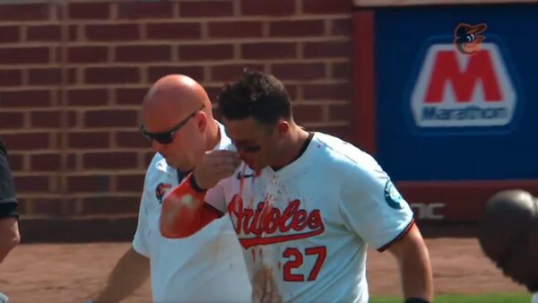 James McCann nose injury