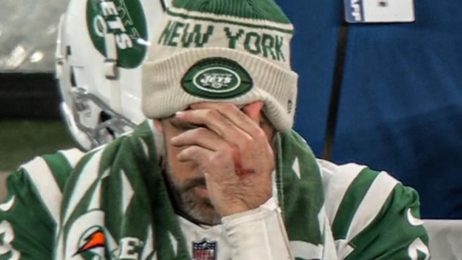 aaron-rodgers-blood-L-jets.jpg