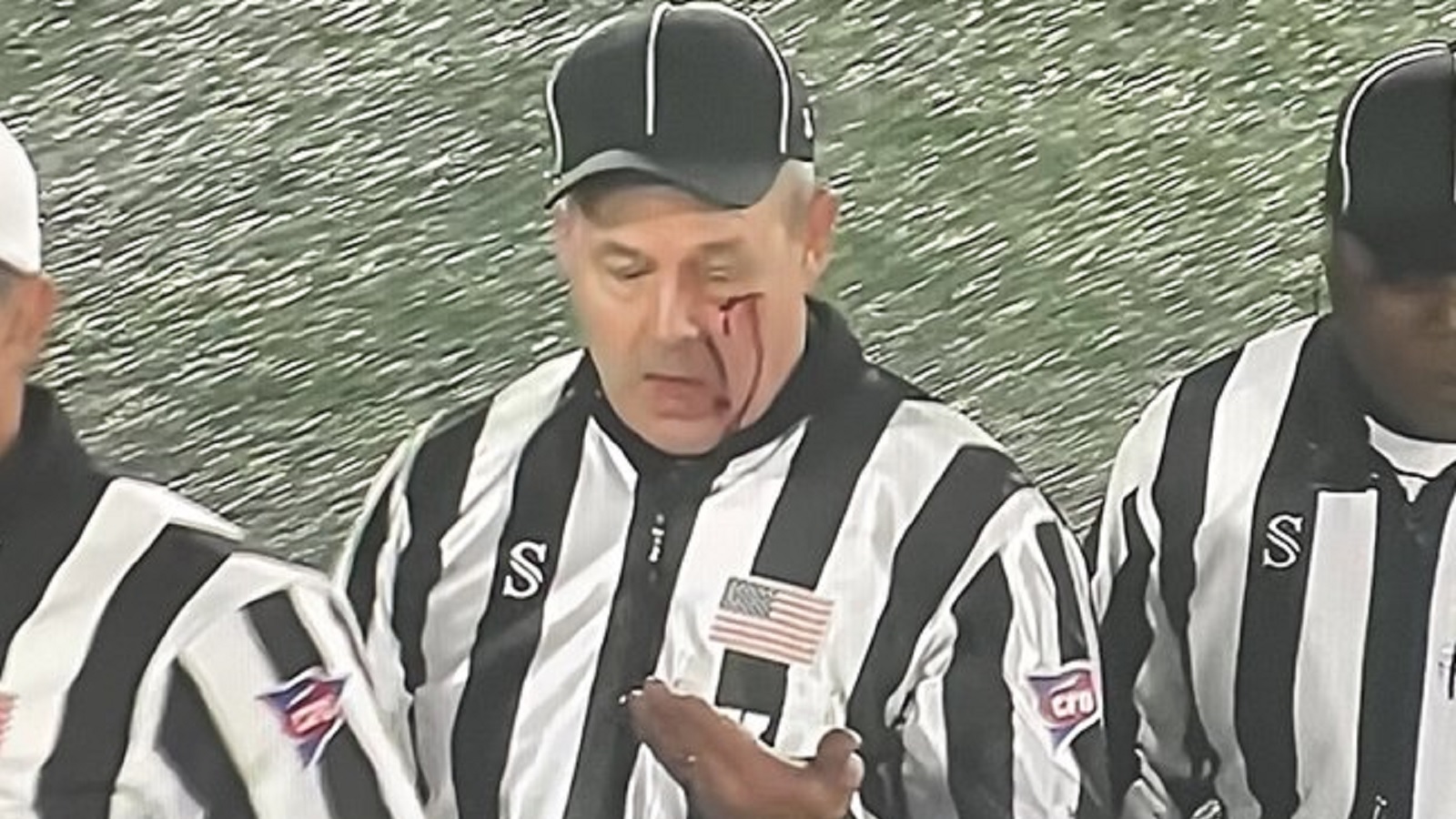 Referee gets bloodied during fight between East Carolina and NC State