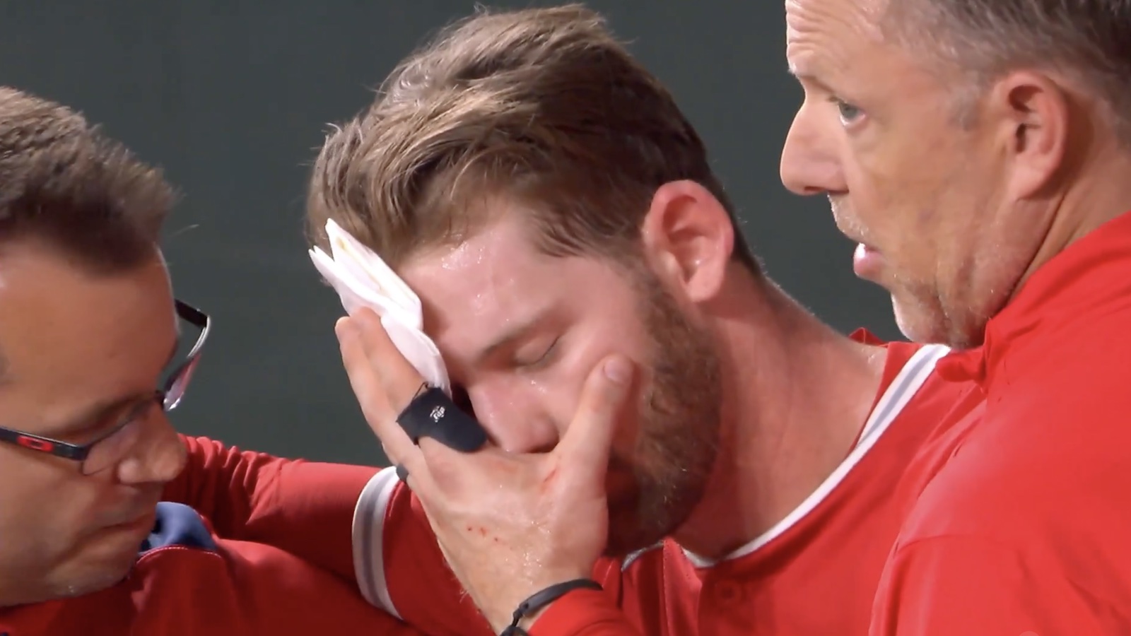 Angels outfielder Taylor Ward with blood on his face