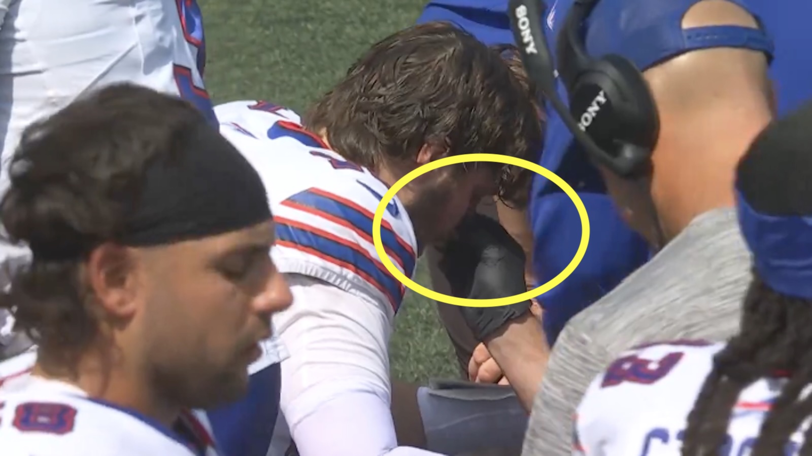 Josh Allen has a bloody nose tended to
