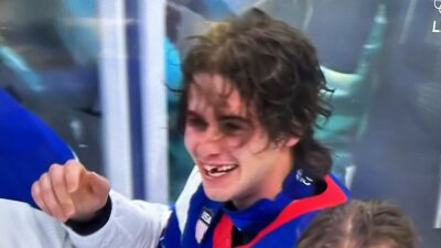 Jack Hughes missing his teeth