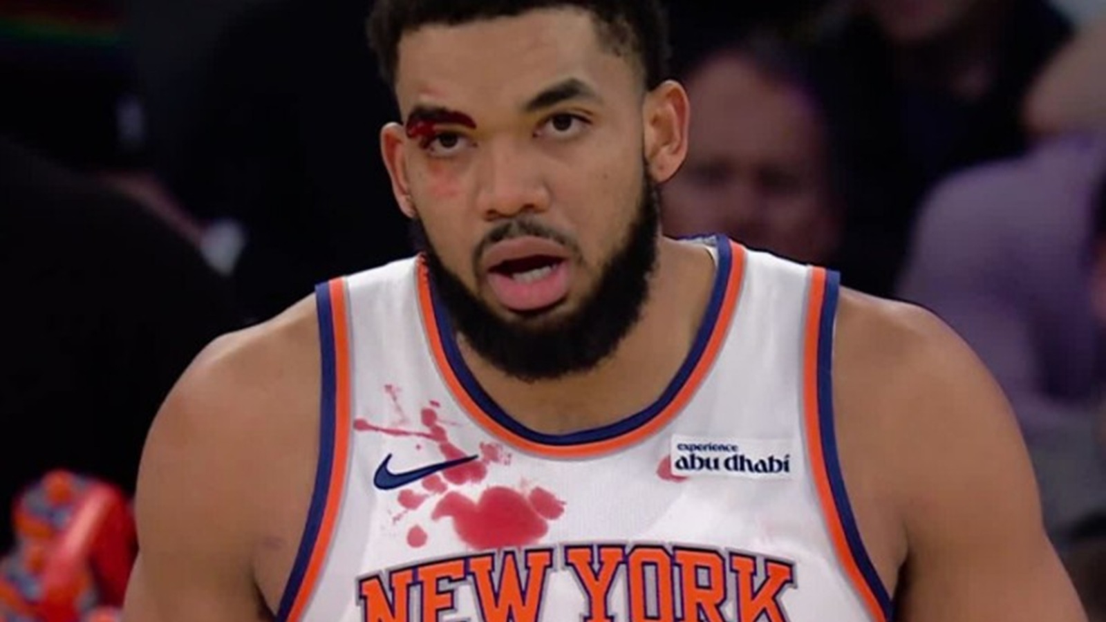 Karl-Anthony Towns bleeding onto his jersey
