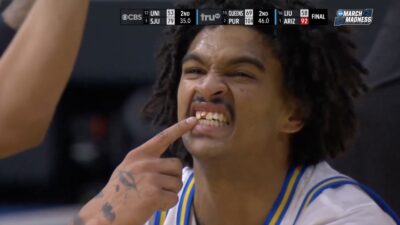 UCLA player Skyy Clark pointing to his chipped tooth