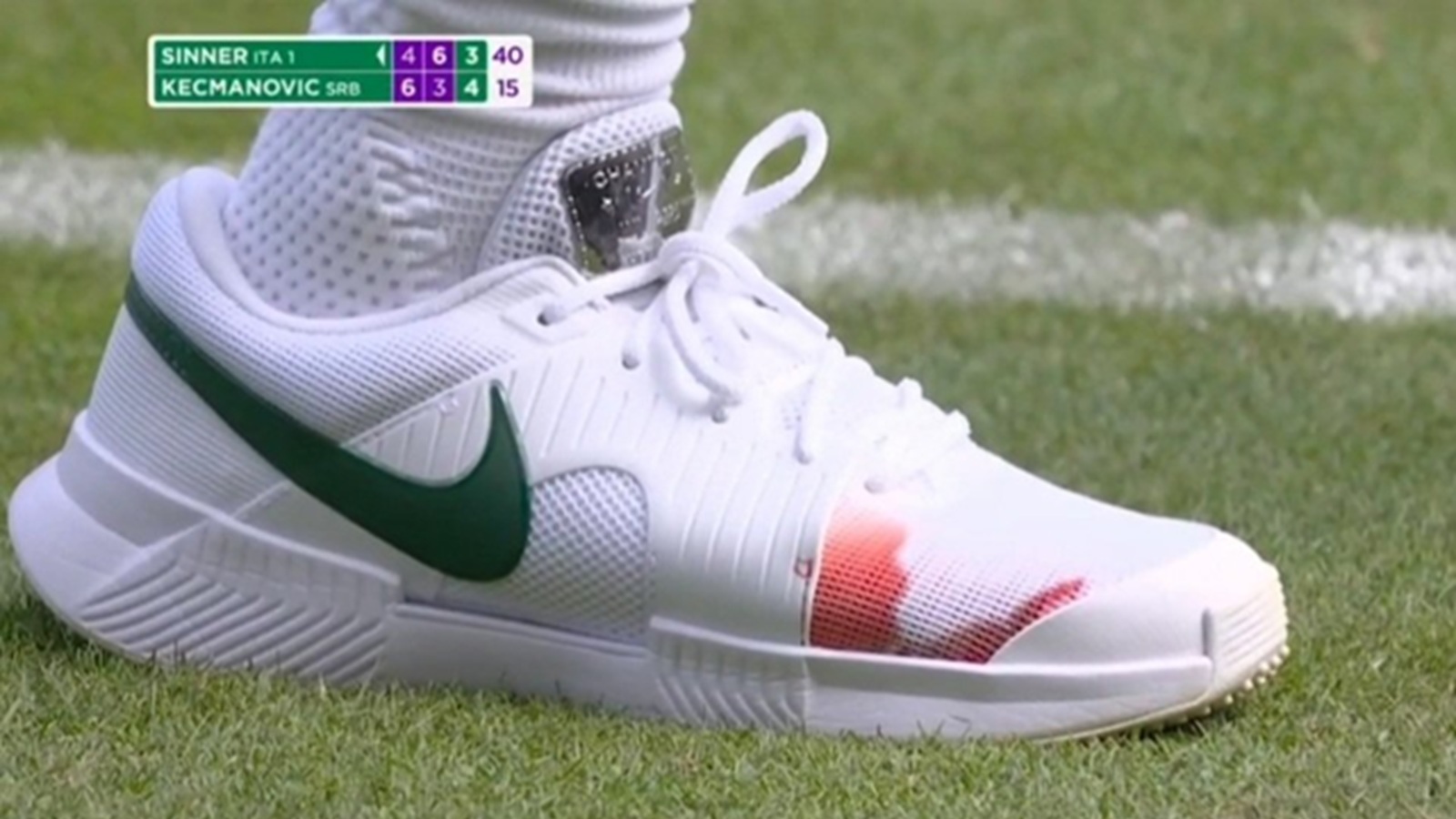 Jannik Sinner's bloody shoe