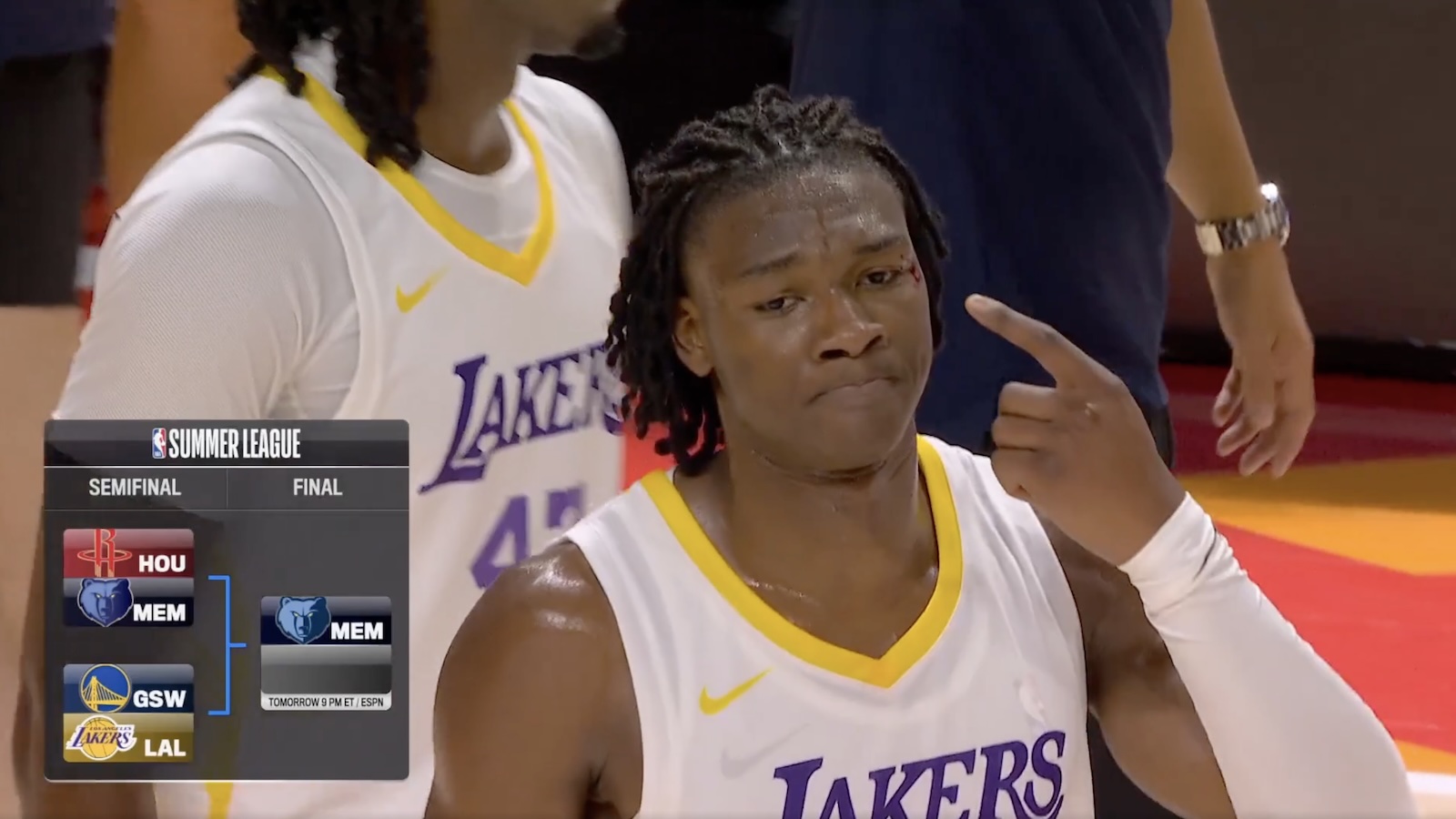 Lakers guard Adou Thiero pointing at a bloody cut on his head during an NBA Summer League game against the Warriors