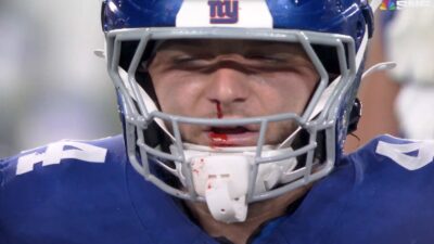 Giants running back Cam Skattebo with a bloody nose