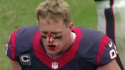 JJ Watt blood