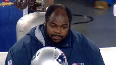 Vince Wilfork hair bald