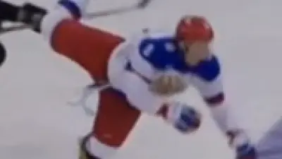 Alex Ovechkin leg injury