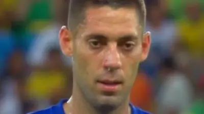 Clint Dempsey broken nose