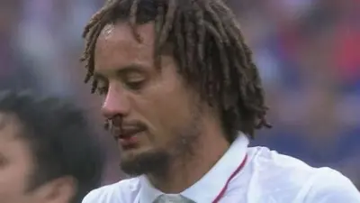 Jermaine Jones bloody nose