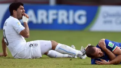 Luis Suarez bite