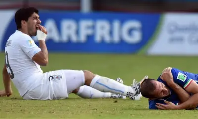 Luis Suarez bite