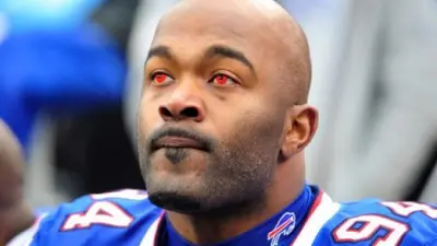 Mario Williams red eyes contacts