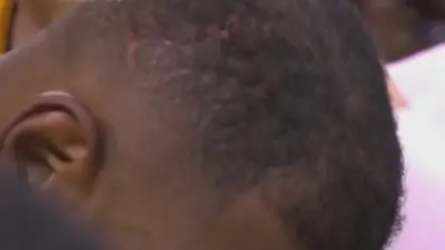 LeBron James cut head