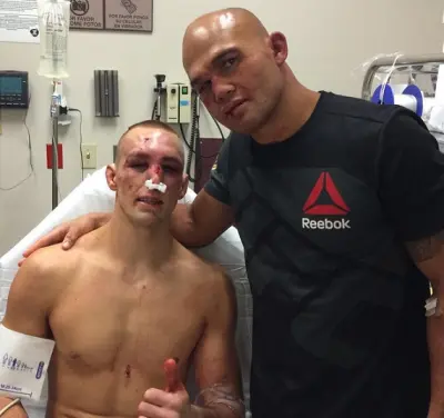 Rory MacDonald nose