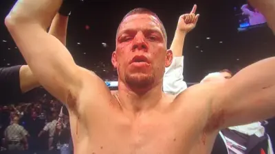 Nate Diaz