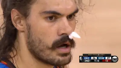 Steven Adams nose