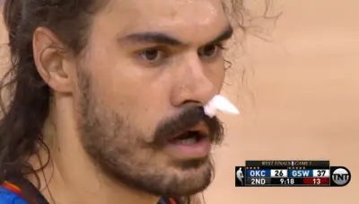 Steven Adams nose