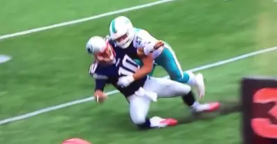Jimmy Garoppolo injury