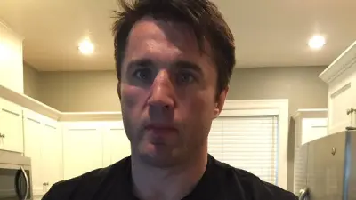 Chael Sonnen