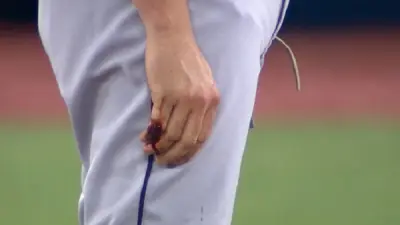 Trevor Bauer bloody finger