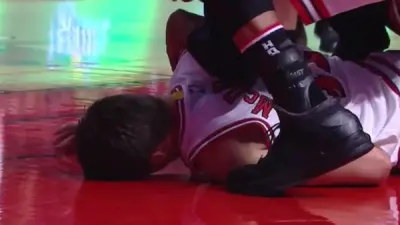 Doug McDermott concussion