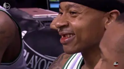 Isaiah Thomas tooth