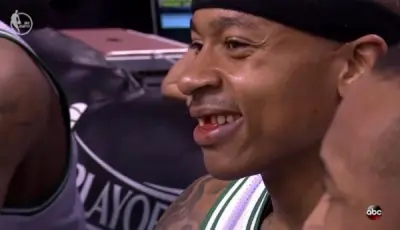 Isaiah Thomas tooth