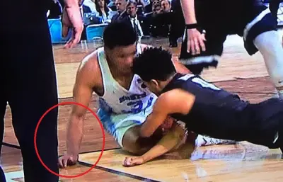 Kennedy Meeks hand