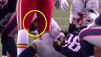 Travis Kelce groin
