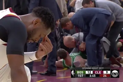 Gordon Hayward leg