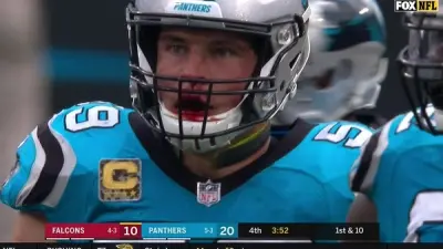 Luke Kuechly bloody nose
