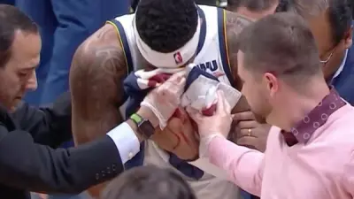 Torrey Craig nose