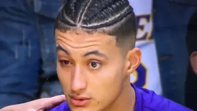 Kyle Kuzma eye