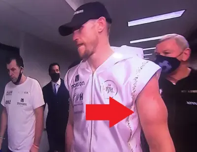 Callum Smith arm biceps
