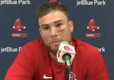 Christian Vazquez eye