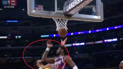 Anthony Davis nose