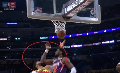 Anthony Davis nose