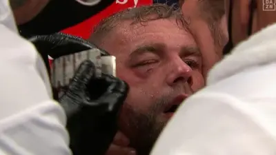 Billy Joe Saunders eye