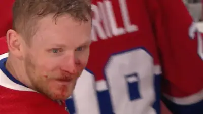Corey Perry bloody