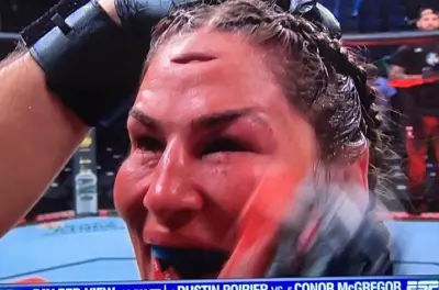 Jessica Eye cut