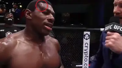 Joaquin Buckley hematoma