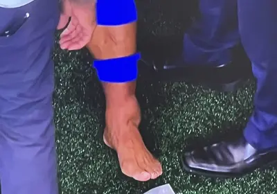 Saquon Barkley swollen ankle