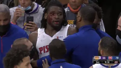 Isaiah Stewart with blood