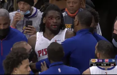 Isaiah Stewart with blood