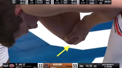Walker Kessler had a bloody elbow
