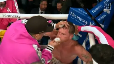 Canelo Alvarez being treated