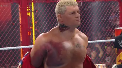 Cody Rhodes with a torn pec